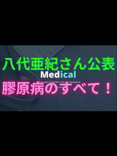 [x]【八代亜紀さん公表】膠原病のすべて！全身性エリテマトーデス、強皮症、初期症状、皮膚筋炎。 - YouTube