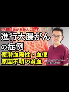 [x]進行大腸がんの症例は？ キーワードは便潜血陽性、血便、原因不明の貧血 教えて久津川先生 No 38 - YouTube