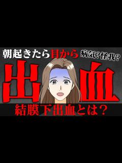[x]【結膜下出血】朝起きたら目が真っ赤！？結膜下出血とは？【医師・まとめ解説】 - YouTube