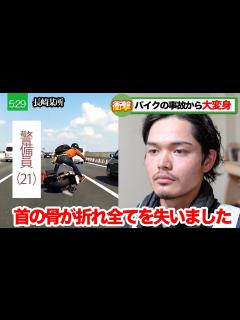 [x]【潰れた顔面】事故で顔面が潰れ歯が無くなった死にかけ男を大変身‼︎ - YouTube