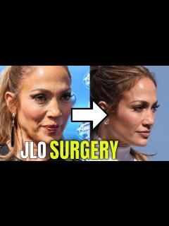 [x]Jennifer Lopez: Plastic Surgery (2020) - YouTube