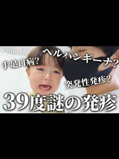 [x]ヘルパンギーナ？手足口病？1歳児が39度高熱からの謎の発疹👶💦【共働き夫婦の育児】 - YouTube