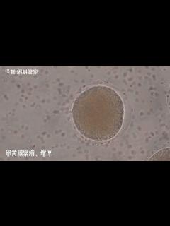 [x]科普：显微镜下真实记录精子与卵子结合全过程（附讲解字幕）_哔哩哔哩_bilibili